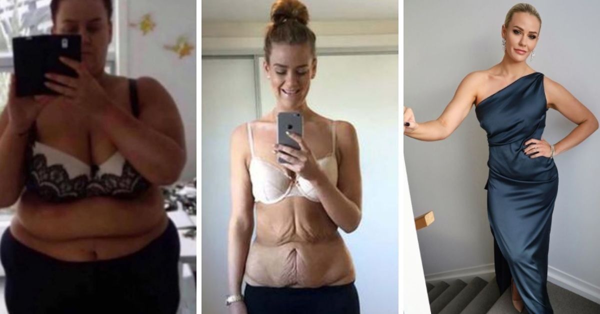 At 372 lbs, She Went From Struggling To Move Around To Being 200 lbs Lighter