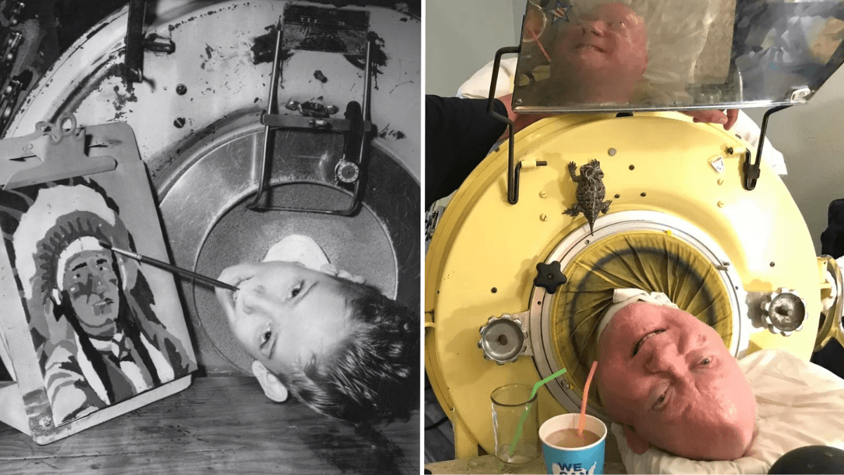 Man Has Spent 72 Years in an Iron Lung - Teaches Us How to Live a Full Life