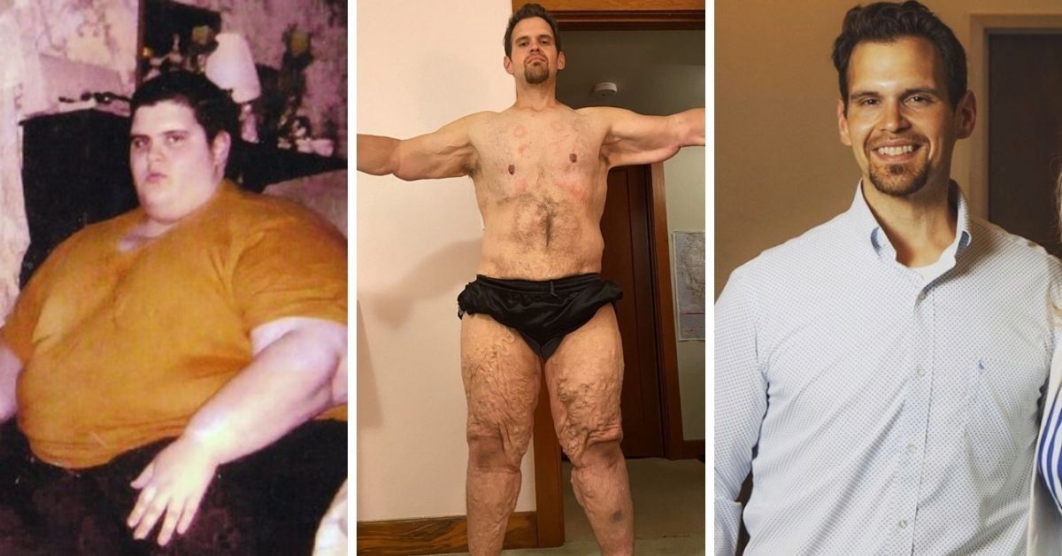 After Finding Out He Might Die, He Defied The Odds and  Lost 600 Pounds