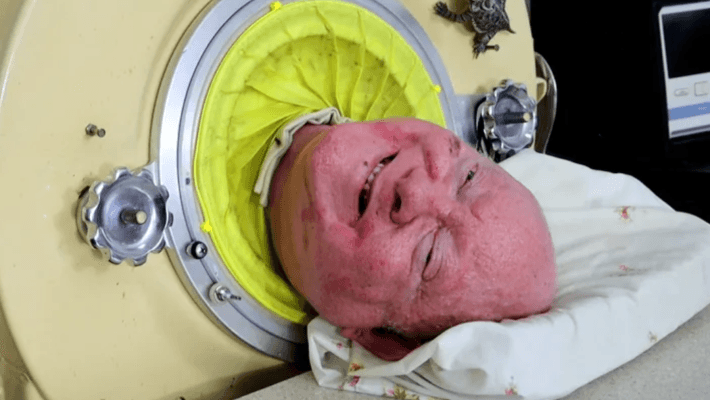 the man in the iron lung