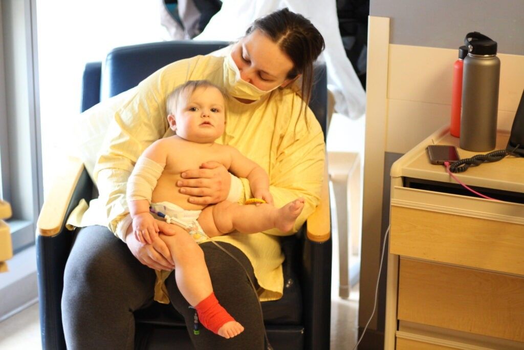 Transformation-before