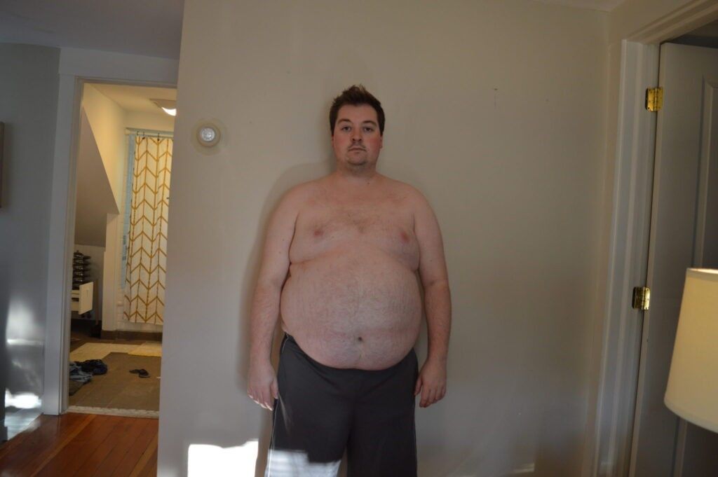 dr-kevin-gendreau-before-picture