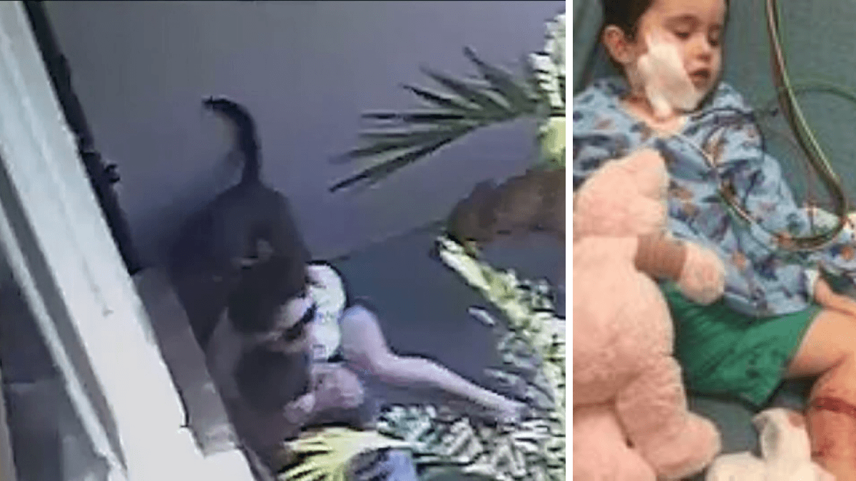 Aggressive Dogs Lunge At Two-Year Old Boy, Mom Acts As A Shield To Save His Life