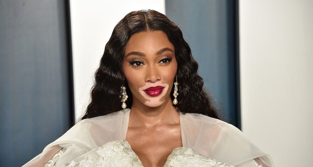 How Winnie Harlow Made It Despite Being Eliminated From America's Next Top Model