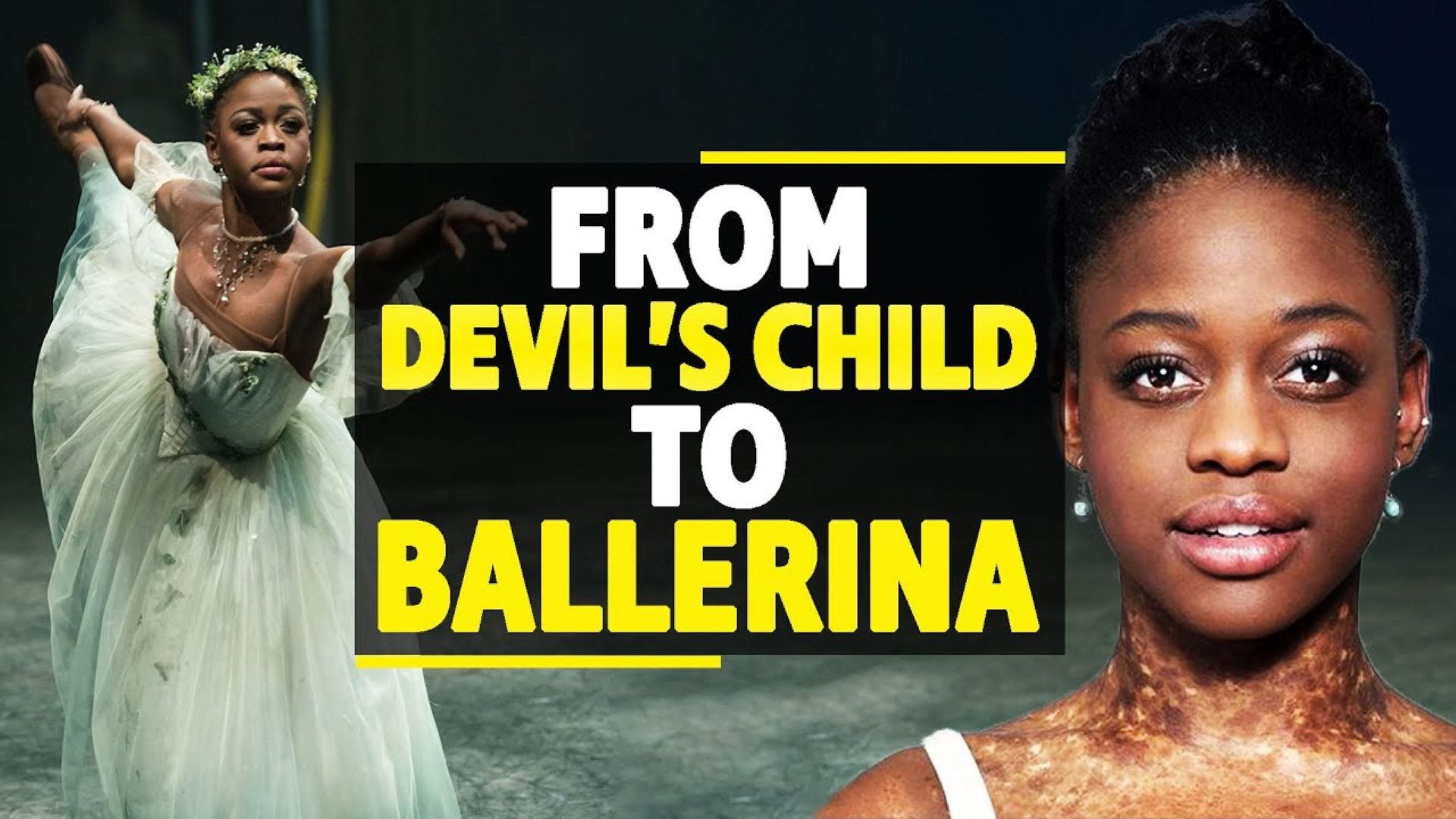 War Orphan Defies The Odds & Becomes A Prima Ballerina