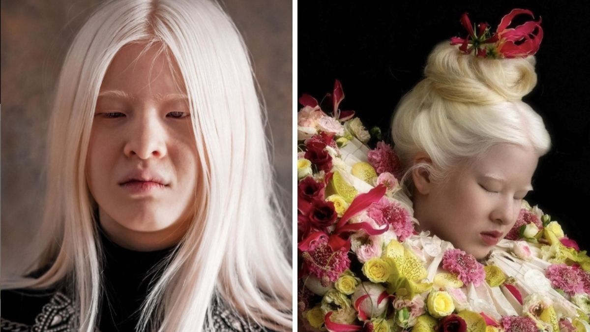 Abandoned By Parents, She Vows To Prove Them Wrong - Today, She Models For Vogue