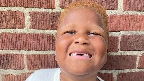 little boy with red hair smiling