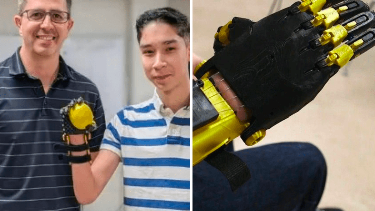 The New Kid at School Has an Underdeveloped Right Hand — So His Classmates Miraculously Create a Robotic Hand for Him